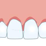Zahn ohne sichtbare Schäden