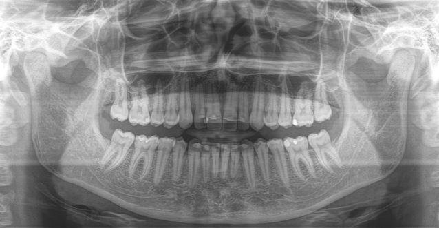 Example of a Cephalogram